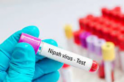 nipah test